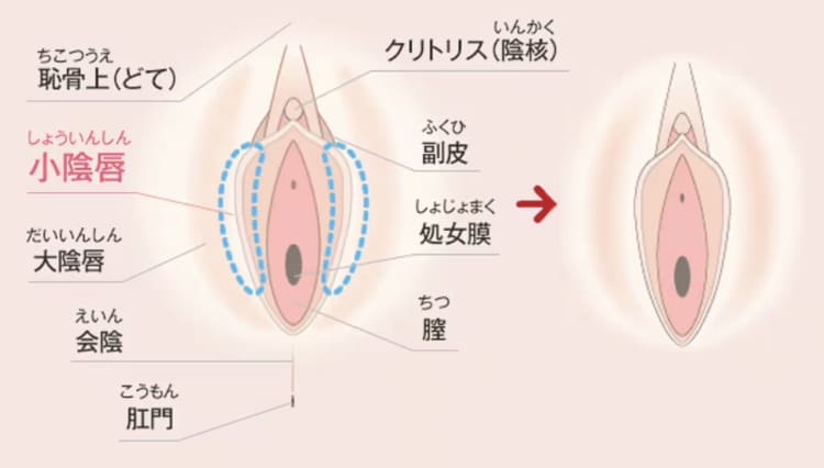 実際の施術方法