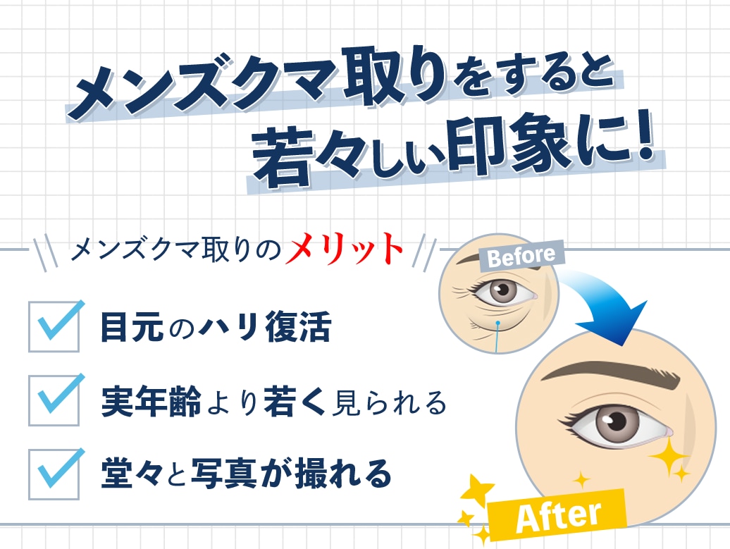 男性クマ取りのメリット