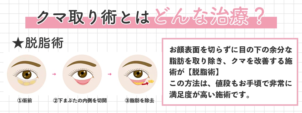 クマ治療ってどんな治療？