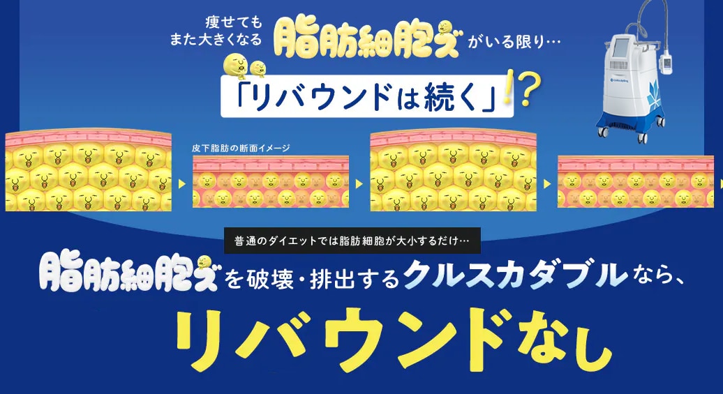 クールスカルプティング：切らない部分痩せ