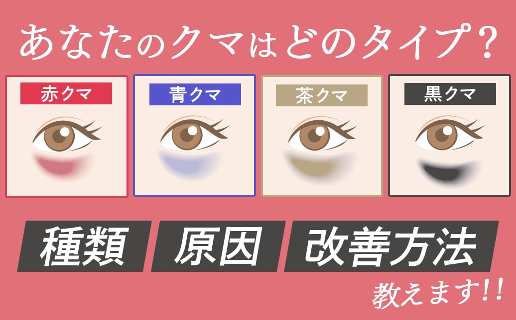 目の下のクマの種類・原因・改善方法を徹底解説！