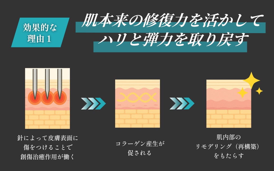 なぜ、モフィウス8がクマに効果的なの？