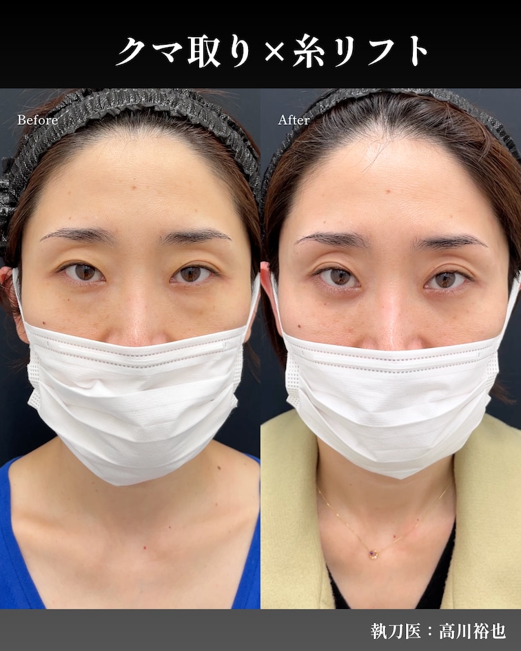3,700名以上の症例実績！高川医師の症例写真