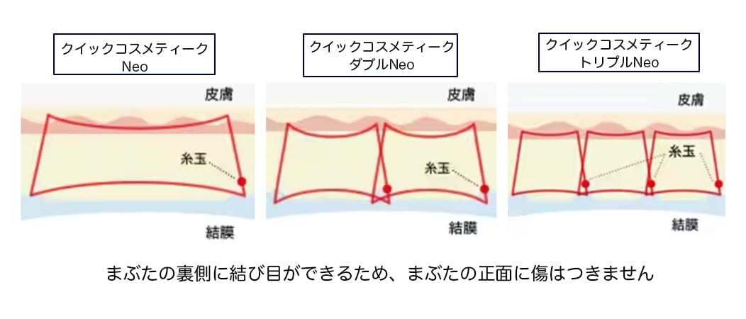 クイックコスメティーク法
