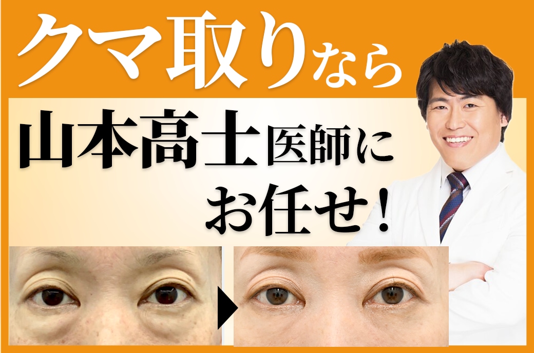 名古屋でクマ取りなら【クマ取り名医】湘南美容クリニック名古屋院の山本医師へお任せ！