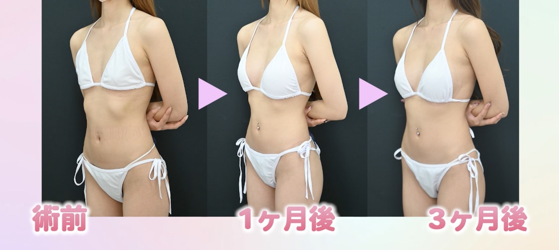 3ヶ月経ってみた感想<br />

