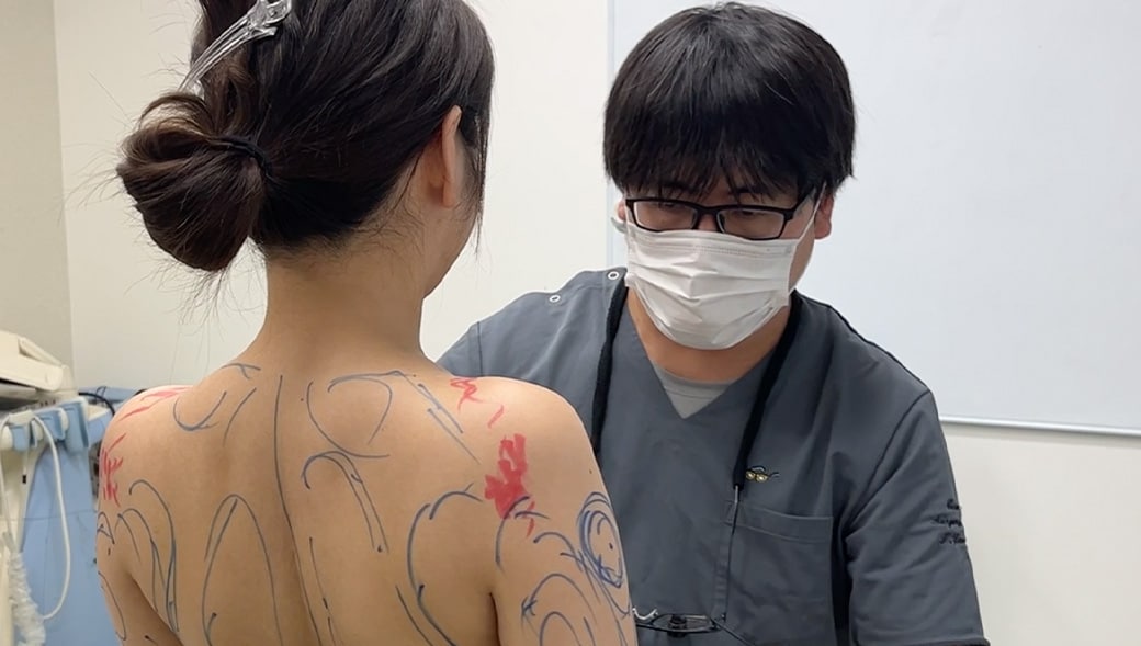 脂肪吸引西日本NO.1（SBC内2024年下半期症例数）山本医師の<br />
脂肪吸引のこだわりはなんですか？