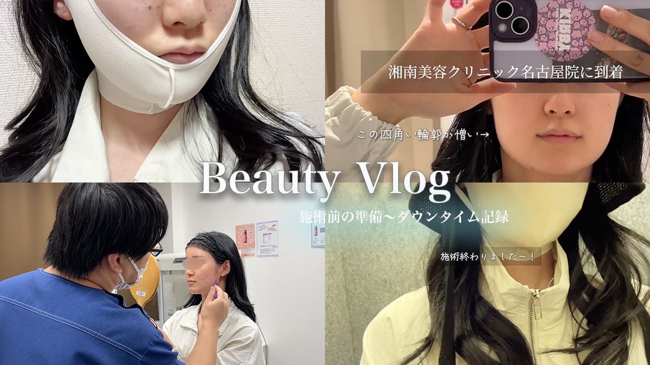 【バッカルファット・糸リフト】四角い顔と野暮ったさ脱却！施術準備からダウンタイムに密着