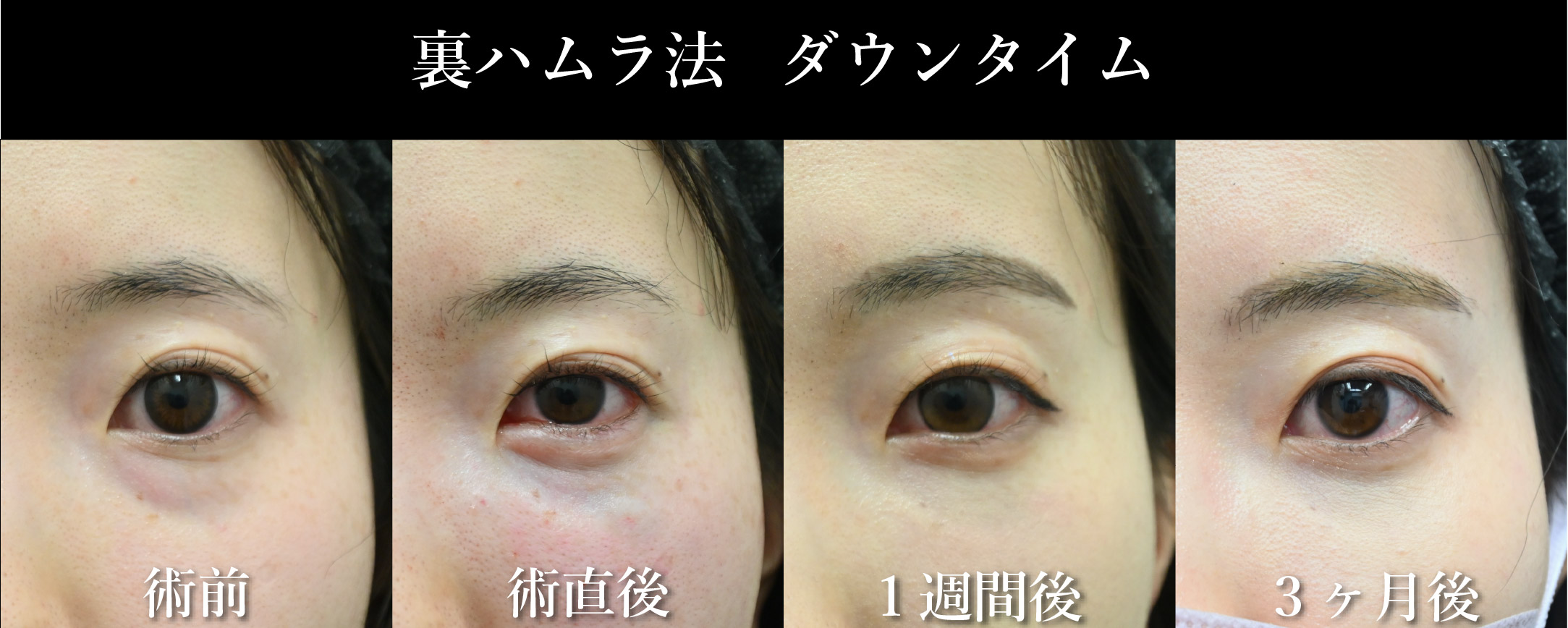 ダウンタイムはどのくらいですか？<br />
