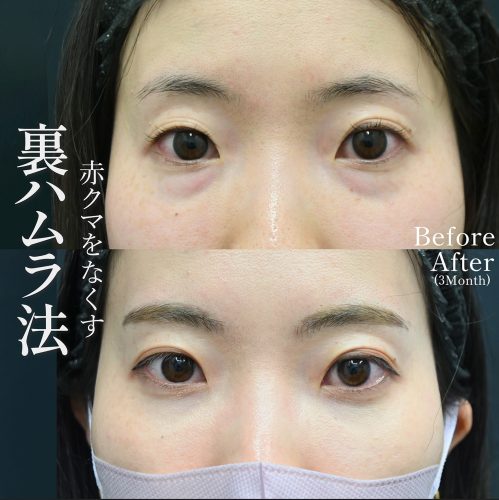 完全に仕上がるまでにはどのくらいの期間がかかりますか？