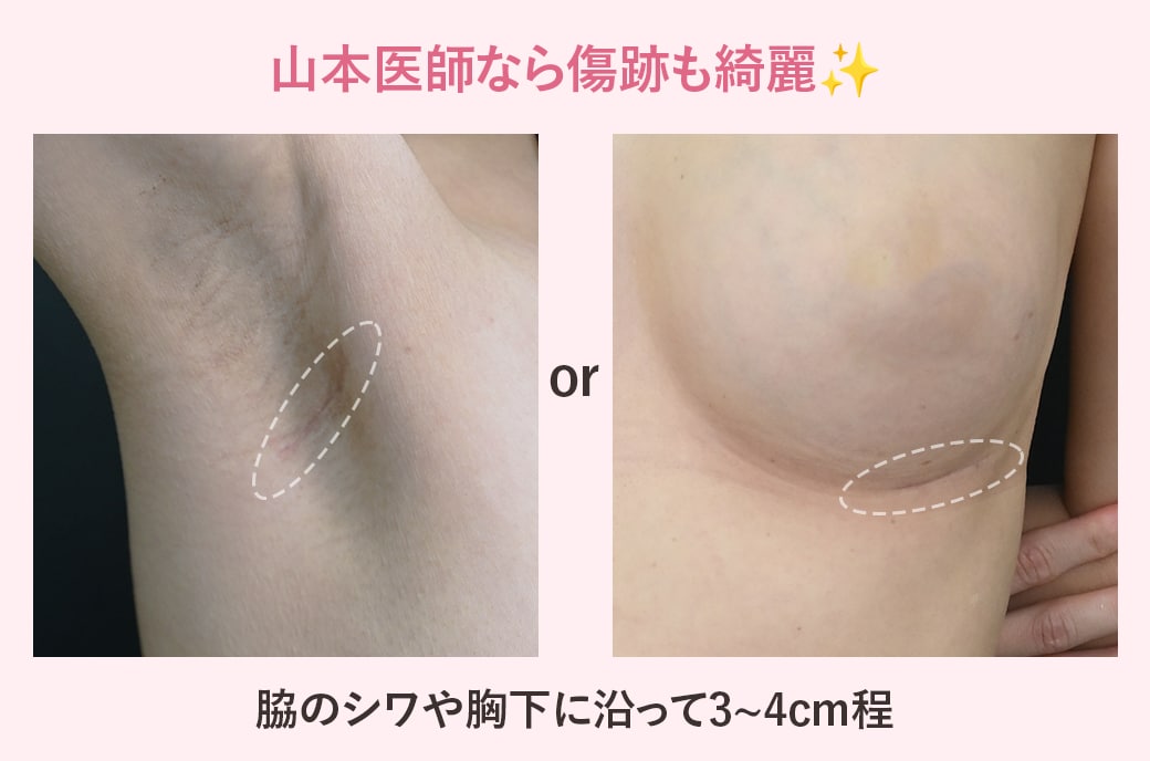 傷跡が目立たない