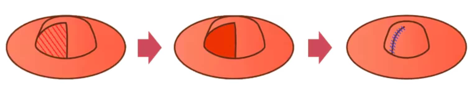 大きさ縮小<br />
