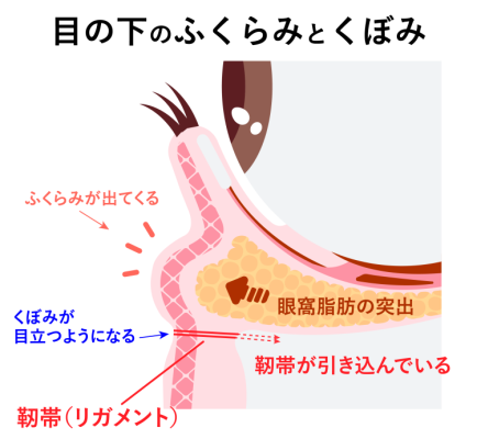 なぜ目の下に「ふくらみ」と「くぼみ」ができるのか？