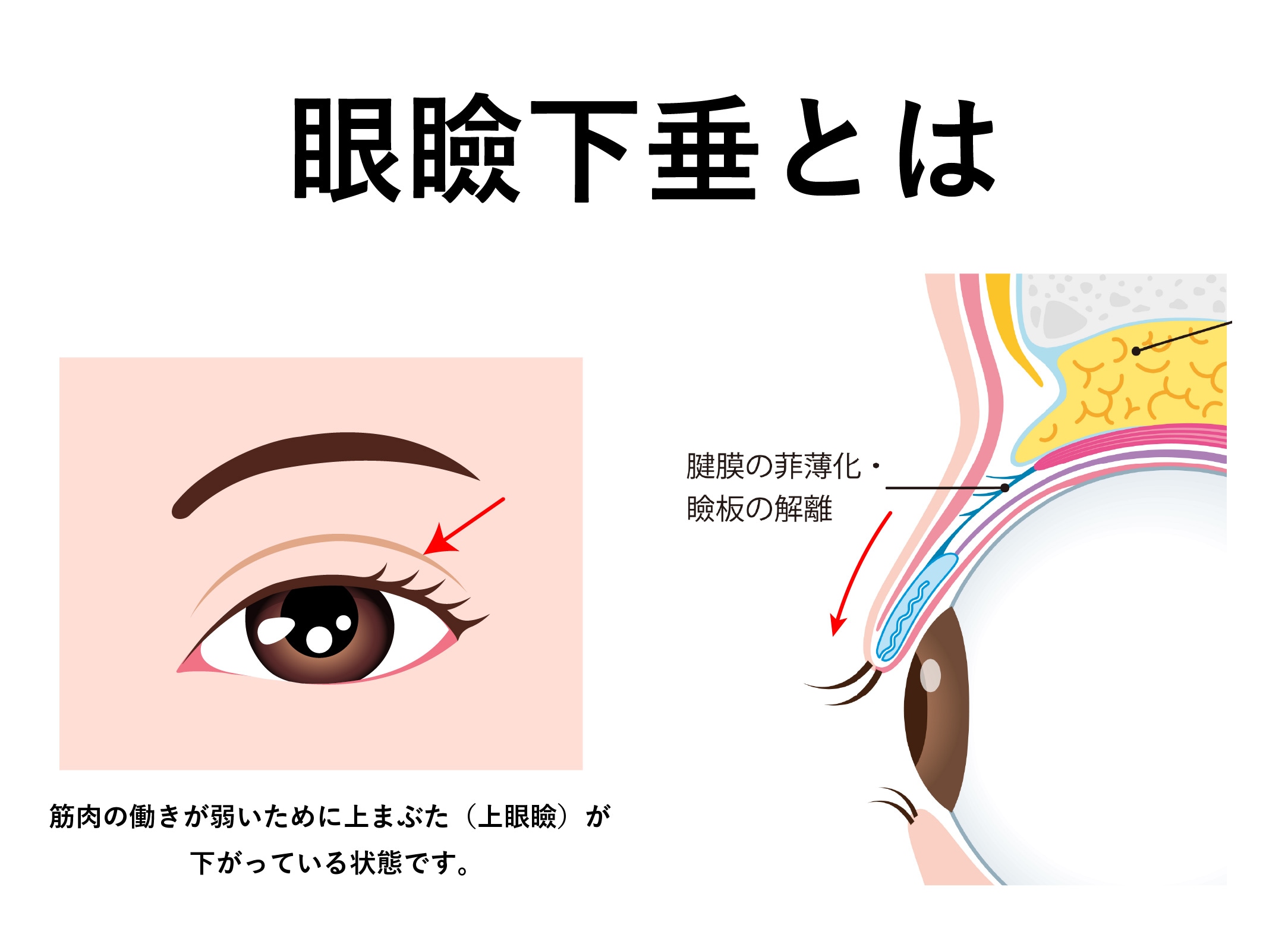 どんな状態？