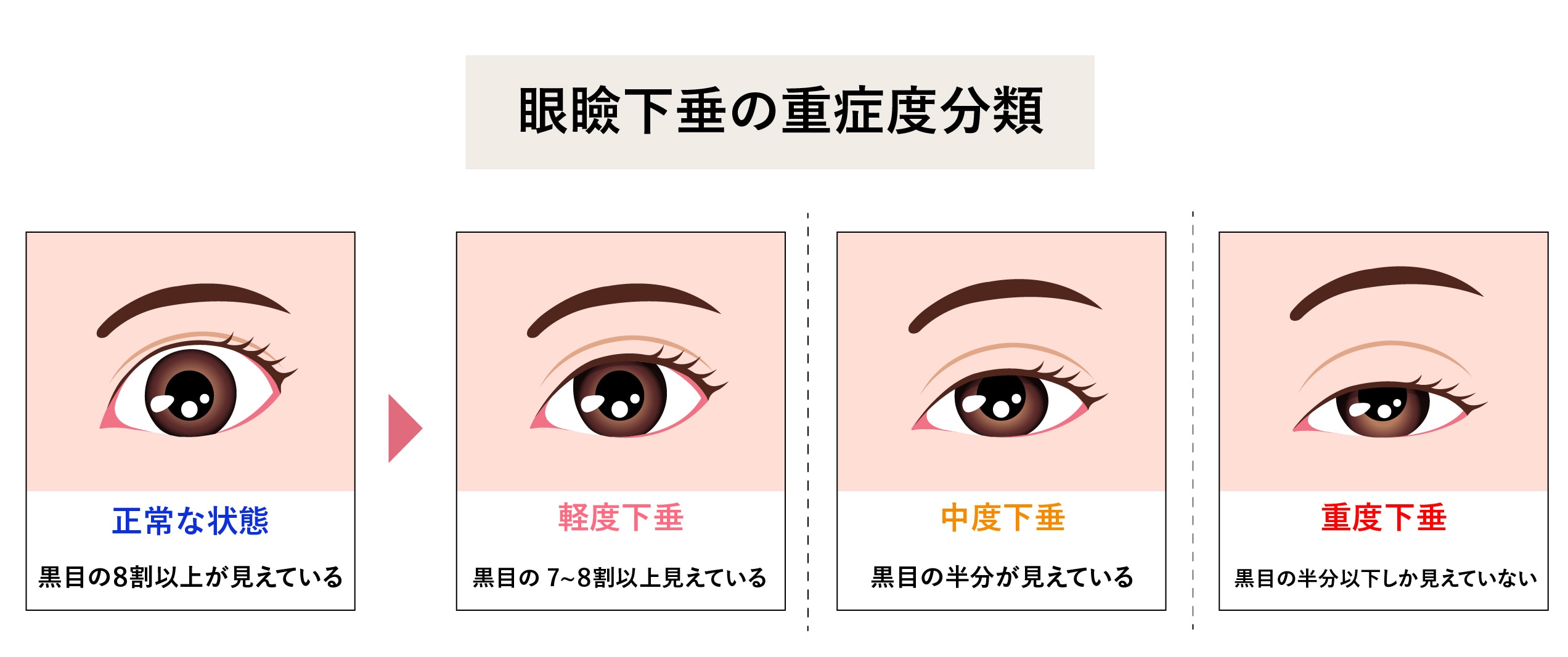 放置すると？