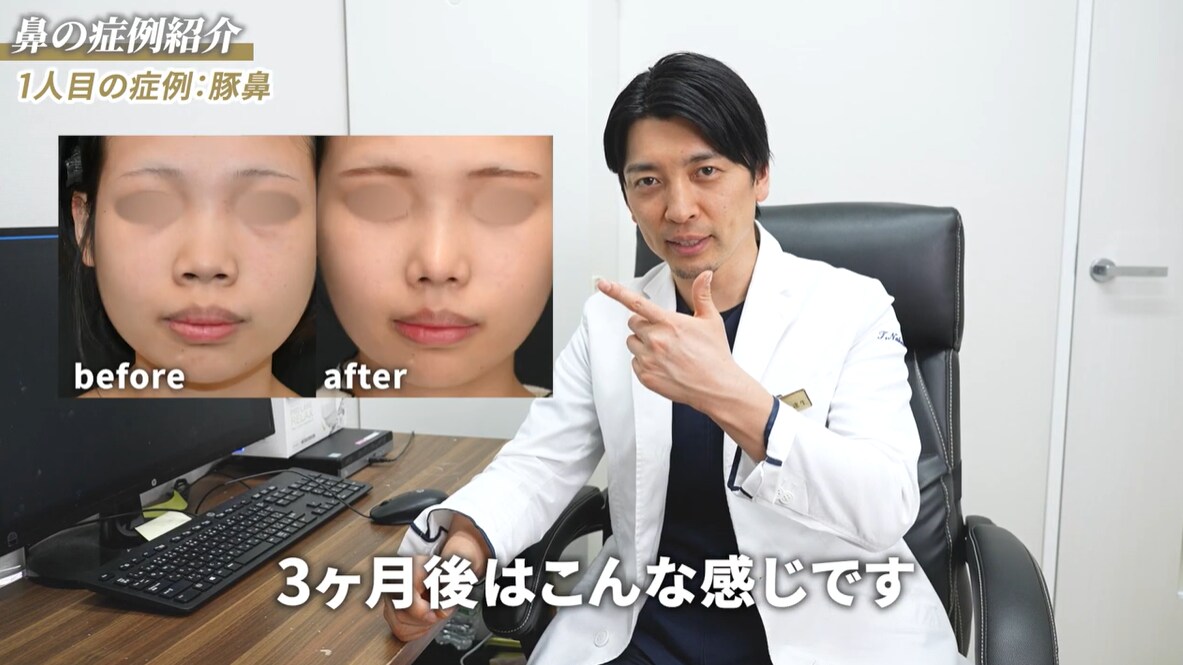 豚鼻の方に