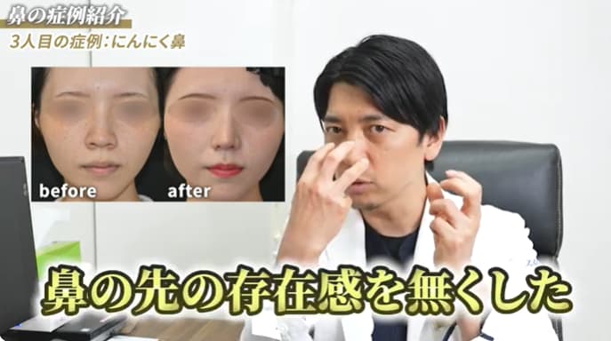 にんにく鼻の方に