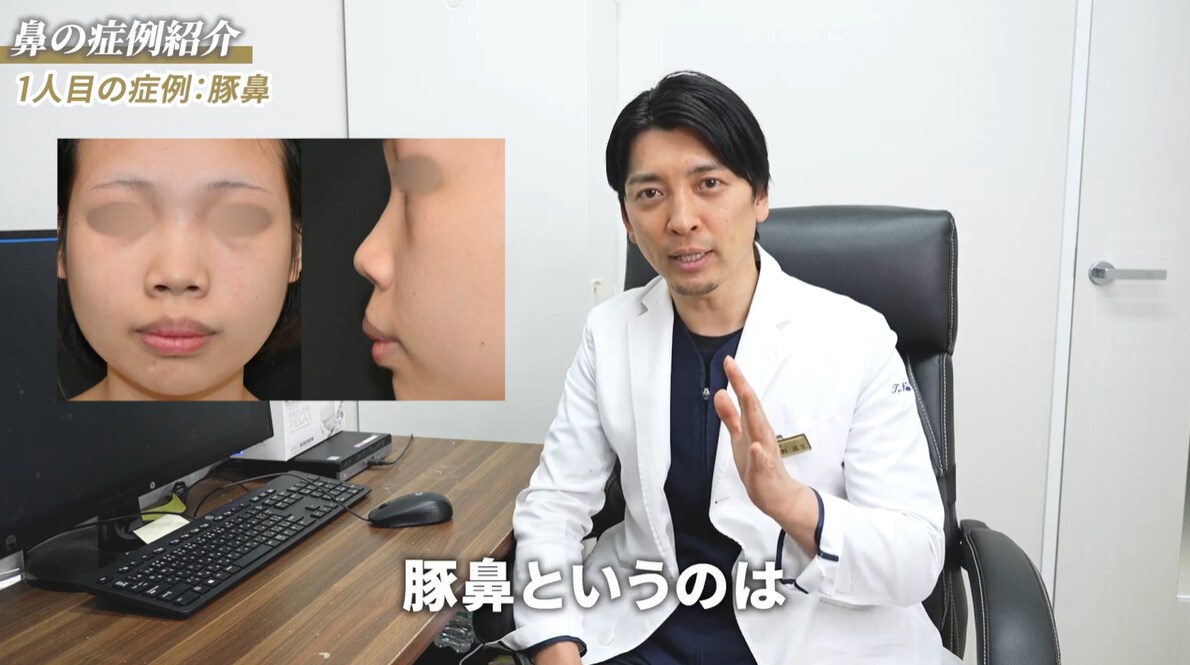 豚鼻について解説