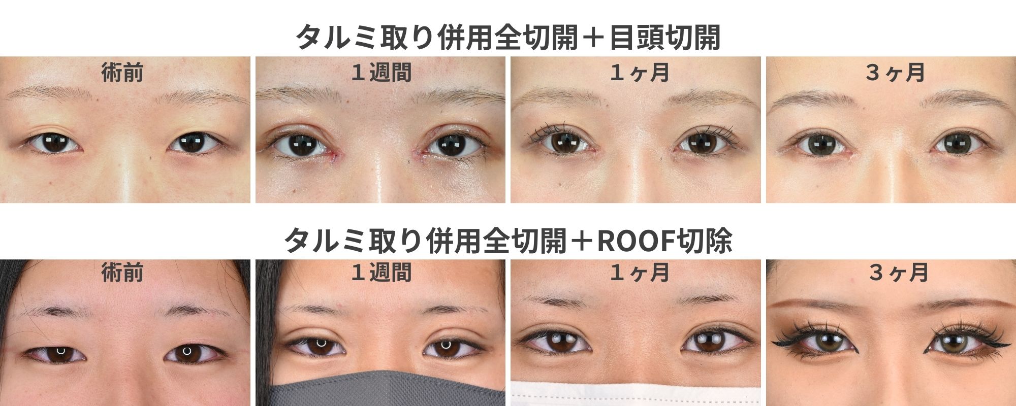 症例