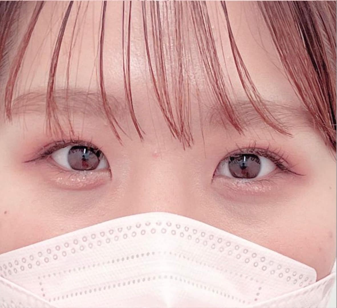 {施術名} {年代}  {性別} の術後の症例写真