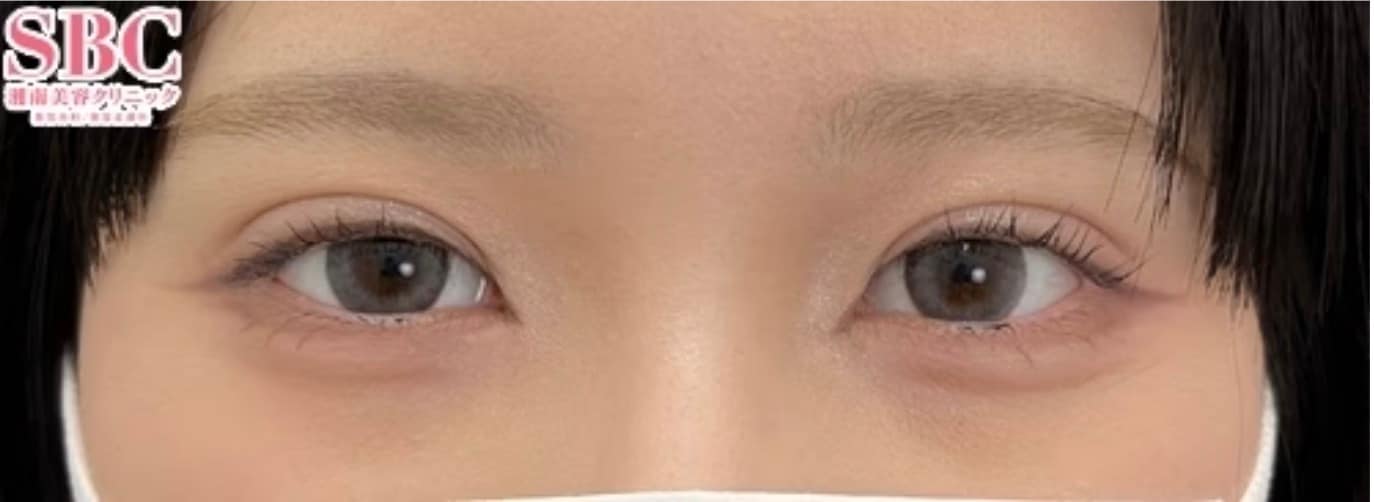 自分に似合う幅でパッチリかわいい☆