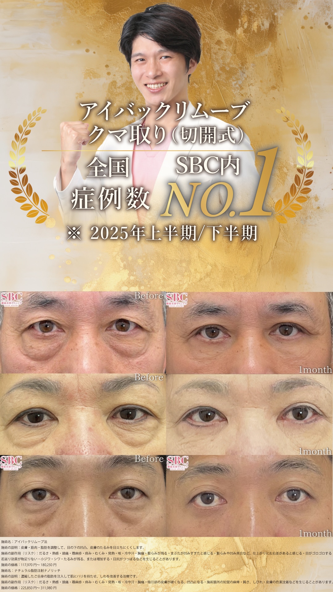 沖縄でクマ取りするなら湘南美容クリニック那覇院！