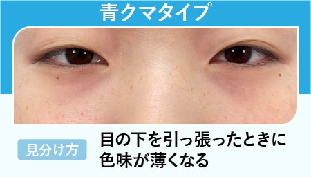 青クマ