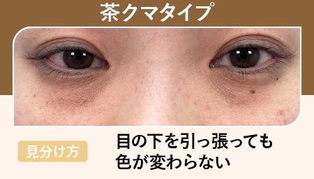 茶クマ