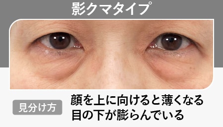 影クマ