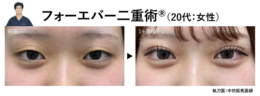 中坊医師の二重症例