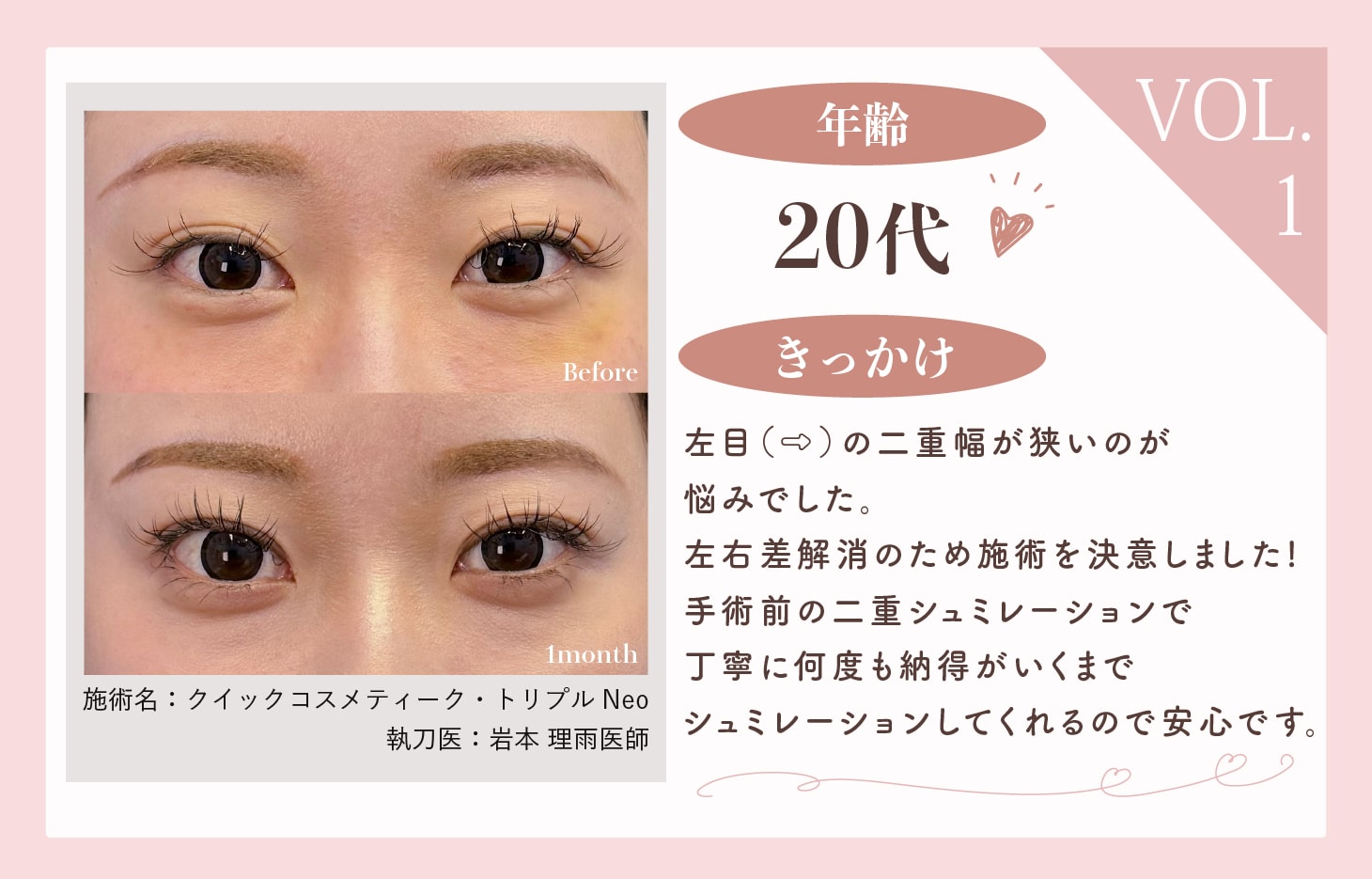 左右差が気になる
