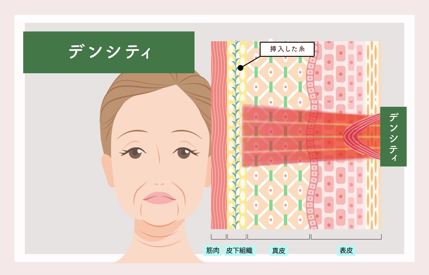 デンシティ