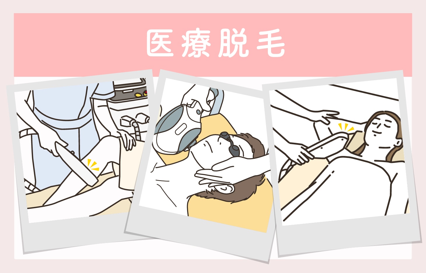 医療脱毛