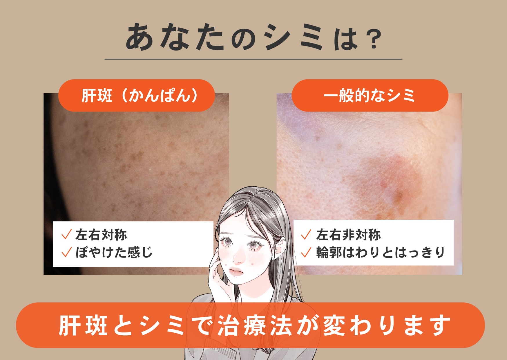 💖シミと肝斑の違いって？💖