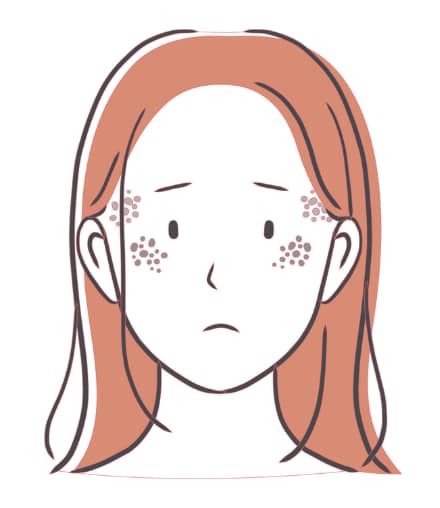 ②深いシミ（ADMなど）