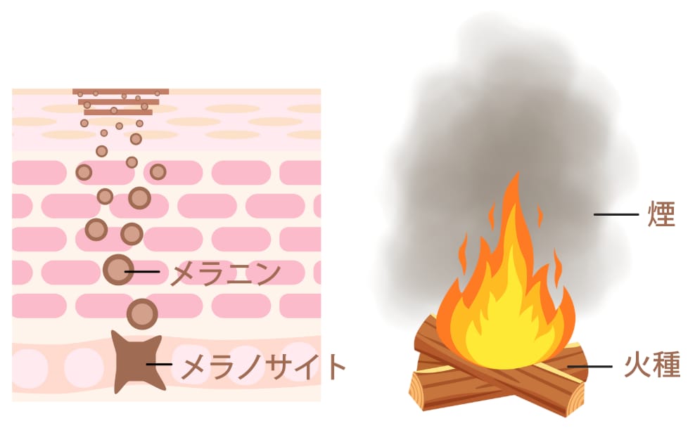 肝斑ができる「仕組み」を知れば大丈夫！