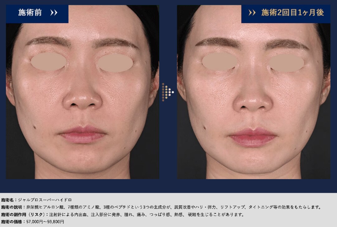 たるみの根本に、アミノ酸の「再生力」を。