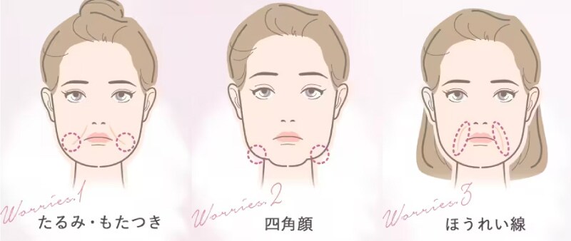 糸リフトはこんな方へおすすめです🤗