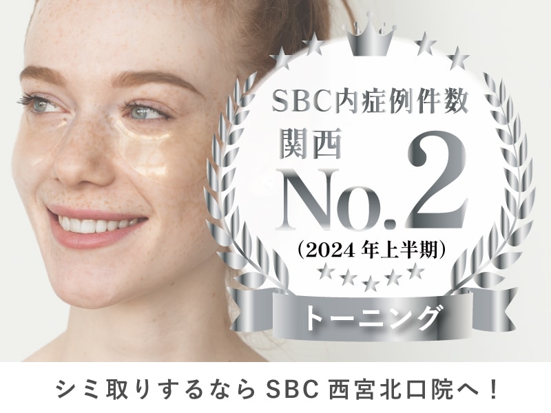 【神戸】西宮市|シミ・肝斑治療レーザートーニングするならSBC西宮北口院へ!