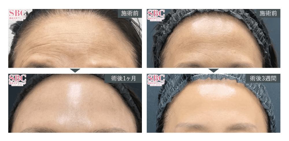 潤いと透明感を同時に叶える“内側からの美肌チャージ”