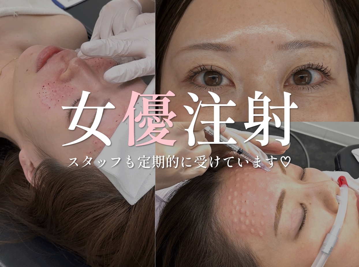 【神戸・西宮市】「リジュラン」と「ボトックス」を組み合わせた女優注射💉 スタッフも定期的に打っています！