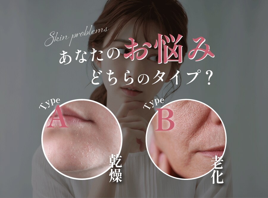 西宮市｜あなたの肌のお悩みは乾燥？老化？【ヒアルロン酸（ボライト/プロファイロ）】