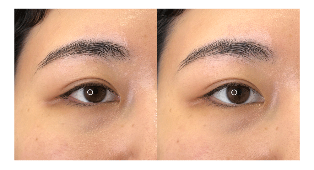 <b>白目部分の拡大</b>（ 左がBEFORE / 右がAFTER ）