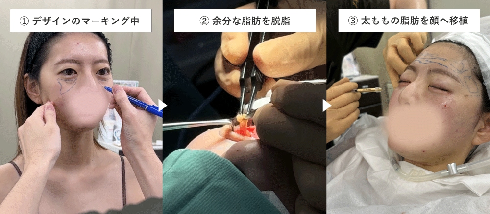 手順