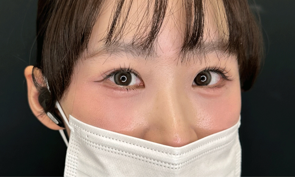 DT10日目