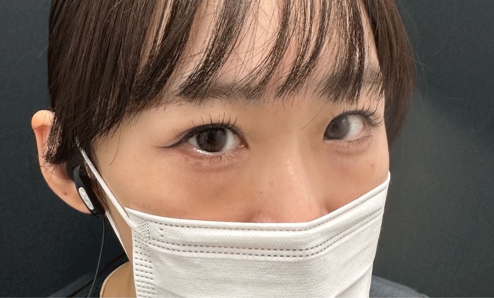 術前