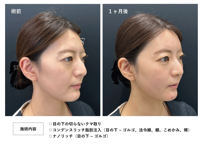 目元だけでなく顔＜トータル＞で若返りに対応
