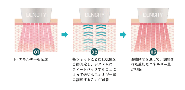 デンシティがおすすめの人