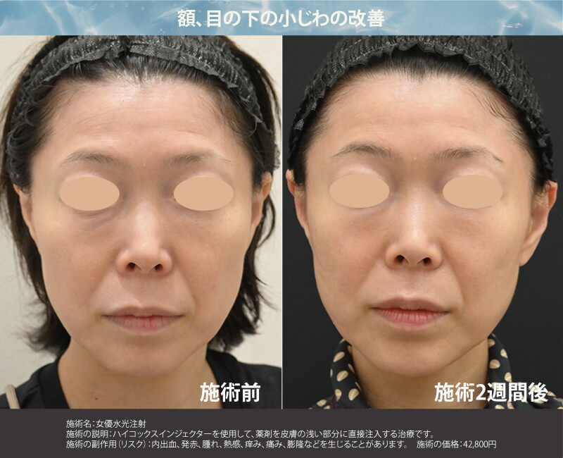 症例写真①