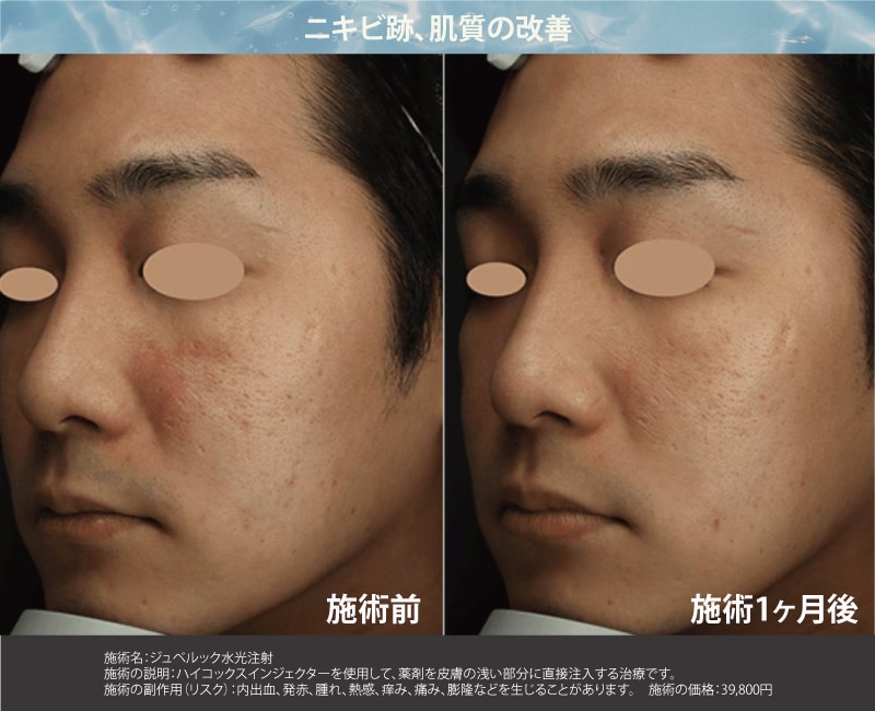 症例写真②